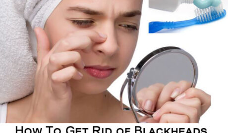 How To Get Rid of Blackheads with Toothpaste and Toothbrush