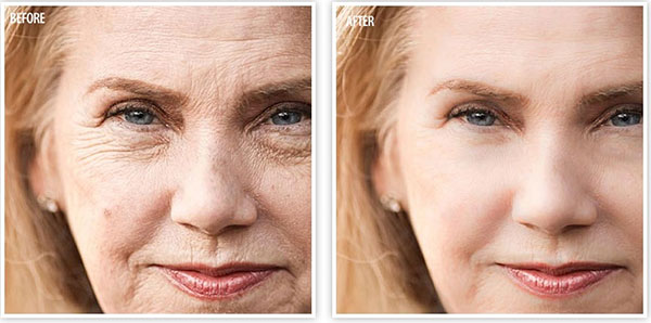 Regain Wrinkles Free Youthful Skin Back with HGH Releasers