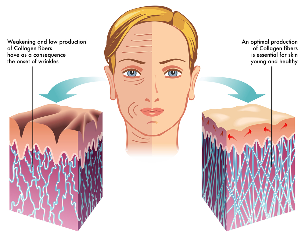 collagen-skin-aging-wrinkles